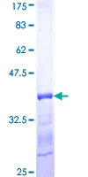 PSPH Protein - 12.5% SDS-PAGE Stained with Coomassie Blue.