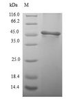 PSPH Protein - (Tris-Glycine gel) Discontinuous SDS-PAGE (reduced) with 5% enrichment gel and 15% separation gel.