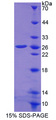 PSPH Protein - Recombinant Phosphoserine Phosphatase (PSPH) by SDS-PAGE