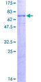 PSPLA1 / Phospholipase A1 Protein - 12.5% SDS-PAGE of human PLA1A stained with Coomassie Blue