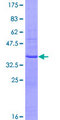 PSPLA1 / Phospholipase A1 Protein - 12.5% SDS-PAGE Stained with Coomassie Blue.