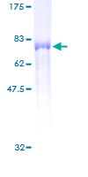 PSTPIP1 Protein - 12.5% SDS-PAGE of human PSTPIP1 stained with Coomassie Blue