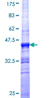 PSTPIP1 Protein - 12.5% SDS-PAGE Stained with Coomassie Blue.