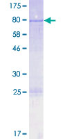 PTBP3 / ROD1 Protein - 12.5% SDS-PAGE of human ROD1 stained with Coomassie Blue