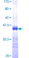 PTBP3 / ROD1 Protein