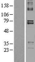 PTCD1 Protein - Western validation with an anti-DDK antibody * L: Control HEK293 lysate R: Over-expression lysate