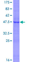 PTCH1 / Patched 1 Protein - 12.5% SDS-PAGE of human PTCH stained with Coomassie Blue