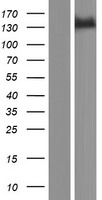PTCH2 / Patched 2 Protein - Western validation with an anti-DDK antibody * L: Control HEK293 lysate R: Over-expression lysate