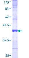 PTCH2 / Patched 2 Protein - 12.5% SDS-PAGE Stained with Coomassie Blue.