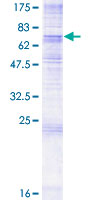 PTDSS1 Protein - 12.5% SDS-PAGE of human PTDSS1 stained with Coomassie Blue