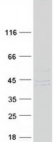 PTER Protein - Purified recombinant protein PTER was analyzed by SDS-PAGE gel and Coomassie Blue Staining