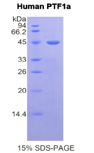 PTF1A Protein - Recombinant Pancreas Specific Transcription Factor 1a By SDS-PAGE