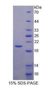 PTGER1 / EP1 Protein - Recombinant Prostaglandin E Receptor 1 By SDS-PAGE