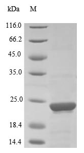 PTGES3 / p23 Protein - (Tris-Glycine gel) Discontinuous SDS-PAGE (reduced) with 5% enrichment gel and 15% separation gel.