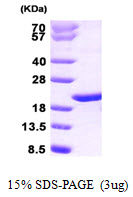 PTGES3 / p23 Protein
