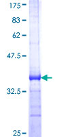 PTGIR / IP Receptor Protein - 12.5% SDS-PAGE Stained with Coomassie Blue.