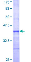 PTGR1 / LTB4DH Protein - 12.5% SDS-PAGE Stained with Coomassie Blue.
