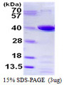 PTGR1 / LTB4DH Protein