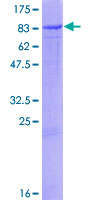 PTGS1 / COX-1 Protein - 12.5% SDS-PAGE of human PTGS1 stained with Coomassie Blue
