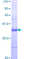 PTGS1 / COX-1 Protein - 12.5% SDS-PAGE Stained with Coomassie Blue.