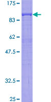 PTGS2 / COX2 / COX-2 Protein - 12.5% SDS-PAGE of human PTGS2 stained with Coomassie Blue
