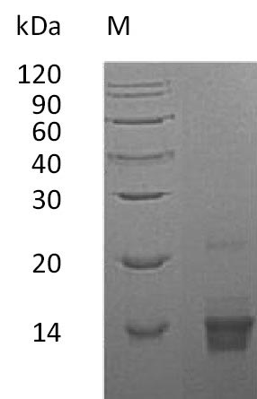 PTH / Parathyroid Hormone Protein - (Tris-Glycine gel) Discontinuous SDS-PAGE (reduced) with 5% enrichment gel and 15% separation gel.