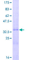 PTH / Parathyroid Hormone Protein - 12.5% SDS-PAGE of human PTH stained with Coomassie Blue