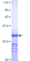 PTH / Parathyroid Hormone Protein - 12.5% SDS-PAGE Stained with Coomassie Blue.