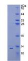 PTH / Parathyroid Hormone Protein - Recombinant Parathyroid Hormone By SDS-PAGE