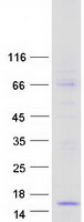 PTH2 / Parathyroid Hormone 2 Protein - Purified recombinant protein PTH2 was analyzed by SDS-PAGE gel and Coomassie Blue Staining