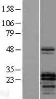 PTHLH / PTHRP Protein - Western validation with an anti-DDK antibody * L: Control HEK293 lysate R: Over-expression lysate