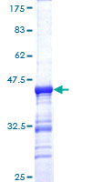 PTHR / PTHR1 Protein - 12.5% SDS-PAGE Stained with Coomassie Blue.