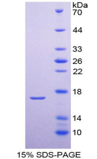 PTHR2 / PTH2R Protein - Recombinant Parathyroid Hormone Receptor 2 By SDS-PAGE