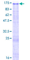 PTK2B / PYK2 Protein - 12.5% SDS-PAGE of human PTK2B stained with Coomassie Blue