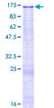PTK2B / PYK2 Protein - 12.5% SDS-PAGE of human PTK2B stained with Coomassie Blue