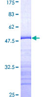 PTK2B / PYK2 Protein - 12.5% SDS-PAGE Stained with Coomassie Blue.