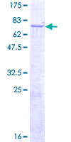 PTK6 / BRK Protein - 12.5% SDS-PAGE of human PTK6 stained with Coomassie Blue