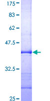 PTK6 / BRK Protein - 12.5% SDS-PAGE Stained with Coomassie Blue.