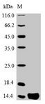 PTMA / Prothymosin Alpha Protein - (Tris-Glycine gel) Discontinuous SDS-PAGE (reduced) with 5% enrichment gel and 15% separation gel.