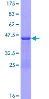 PTMA / Prothymosin Alpha Protein - 12.5% SDS-PAGE of human PTMA stained with Coomassie Blue