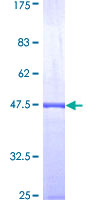 PTMA / Prothymosin Alpha Protein - 12.5% SDS-PAGE Stained with Coomassie Blue.