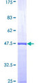 PTMA / Prothymosin Alpha Protein - 12.5% SDS-PAGE Stained with Coomassie Blue.