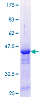 PTMS / Parathymosin Protein - 12.5% SDS-PAGE Stained with Coomassie Blue.