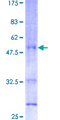PTN / Pleiotrophin Protein - 12.5% SDS-PAGE of human PTN stained with Coomassie Blue