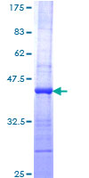 PTN / Pleiotrophin Protein - 12.5% SDS-PAGE Stained with Coomassie Blue.