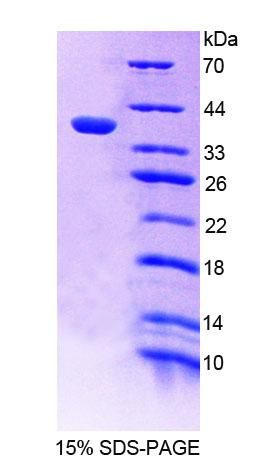 PTP-PEST / PTPN12 Protein - Recombinant Protein Tyrosine Phosphatase, Non Receptor Type 12 (PTPN12) by SDS-PAGE