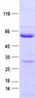 PTP1B Protein