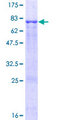 PTP1B Protein - 12.5% SDS-PAGE of human PTPN1 stained with Coomassie Blue