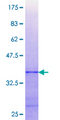PTP1B Protein - 12.5% SDS-PAGE Stained with Coomassie Blue.