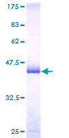 PTP4A1 / PRL-1 Protein - 12.5% SDS-PAGE of human PTP4A1 stained with Coomassie Blue